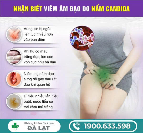 Hình ảnh minh họa